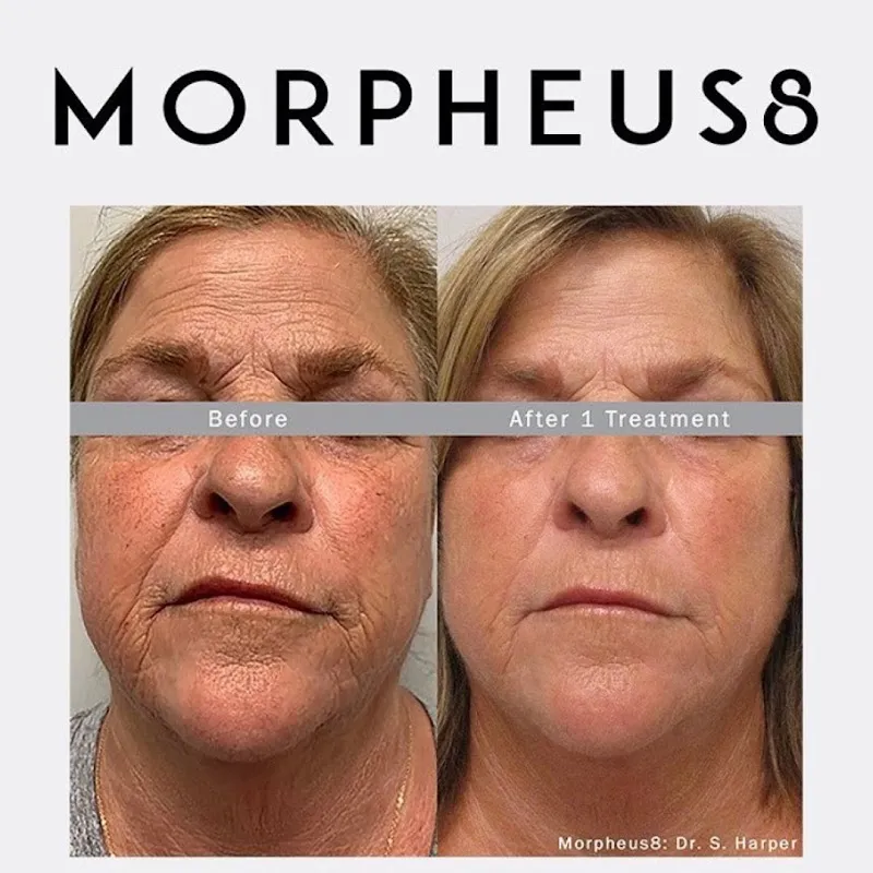 RevitaLife MD photo 3