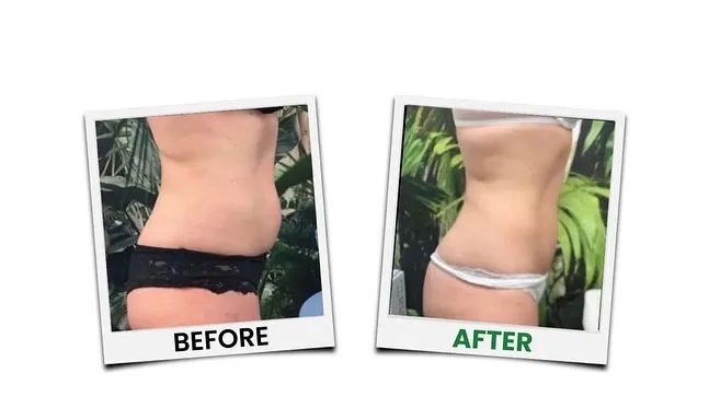 Advanced Wellness and Recovery | Weight-Loss, Hormone Replacement, Integrative Medicine & Massage Therapy photo 4