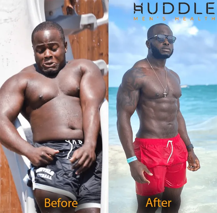 Huddle Men's Health | TRT Clinic in California photo 6