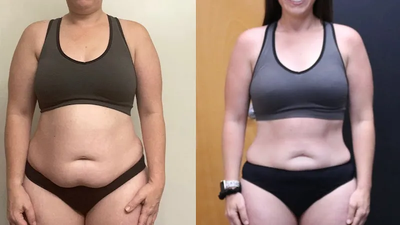 Steel Health and Hormones Centre photo 2