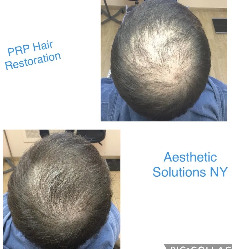 Aesthetic Solutions NY: TMJ, Botox for Migraine, NAD+, Semaglutide, Tirzepatide, Mounjaro, IV Hydration, Meyer's Cocktail. photo 6