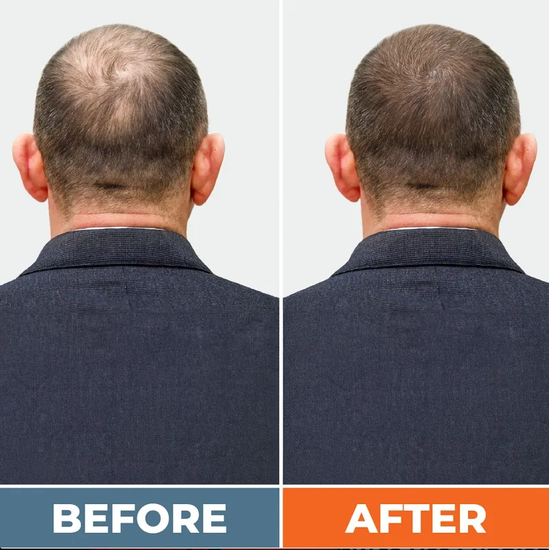 Lowcountry Male Clinic - Anderson, SC - TRT and Weight Loss Services photo 6