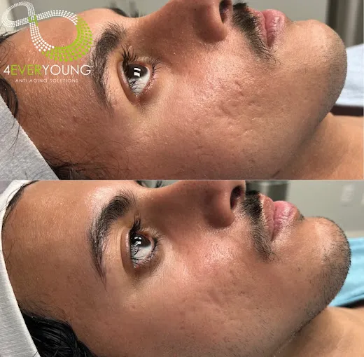 4Ever Young Med Spa & Wellness Center - Philadelphia photo 5